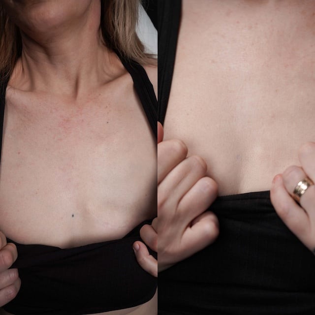 2025 4 22_Fuck%20Cancer640